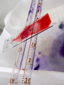 Microscope slide with red strain Stock Photos