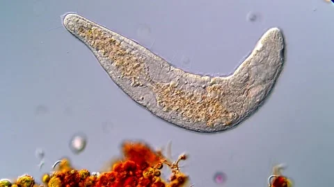 Microscope view of freshwater flatworm, 400x 库存影片 317211050