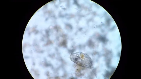 Microscope view of a rotifer, still mysterious unicellular organism Stock-Footage 122108066