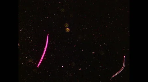 Microscope view, stain, bacteria, nematode Stock Footage 68663346