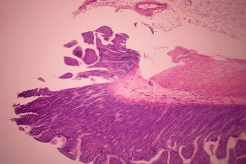Microscope view of stained pink and purple tissue layers. Stock Photos