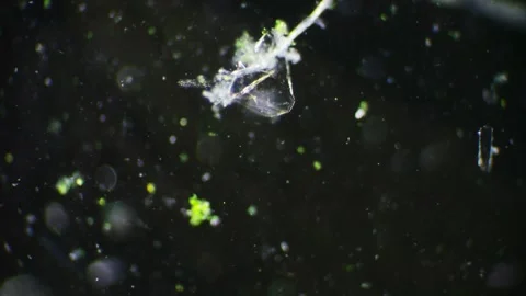 Microscope view of a water droplet teeming with life, including paramecia a.. Stock Footage 274756863