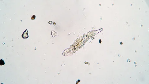 Microscopic animal rotifer in a drop of ... | Stock Video | Pond5