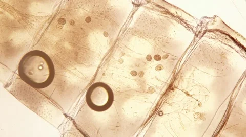 Microscopic animals moving in an empty mayfly nymph skin Stock Footage 58819540
