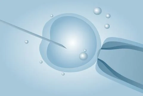 Microscopic artificial insemination, In vitro fertilisation (IVF) - vector il 库存插图