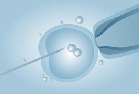 Microscopic artificial insemination, In vitro fertilisation (IVF) - vector il イラスト素材