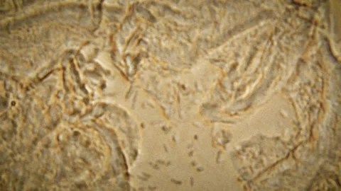 Microscopic Bacteria Urine Close Video stock 153451053