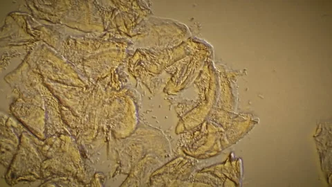 Microscopic Bacteria Urine Medium Stock-Footage 153451066