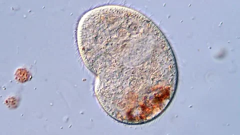 Microscopic Ciliate Protozoa Feeding and Swimming in Water Sample 400x 库存影片 318947150