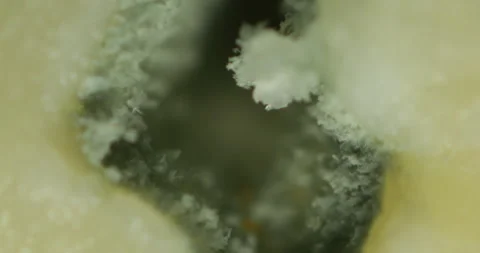 Microscopic Close-Up of Blue Cheese Mold at 100x Stock Footage 293080622