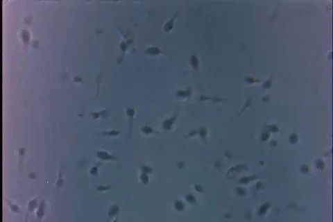 Microscopic difference of active sperm cell and sterile cells - 1960 Video stock 102852671