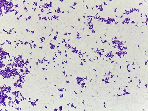 Microscopic Field of Dense, Clumped Bacilli (Rod-Shaped Bacteria) After Gra.. 스톡 사진
