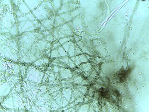 Microscopic Filament Network 스톡 사진