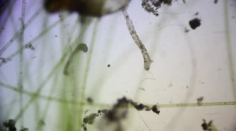 Microscopic filamentous algae and mosquito larvae Stock Footage 59514129