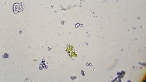 Microscopic green algae and Paramecium caudatum Stock-Footage 87818224
