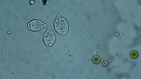 Microscopic green algae and vorticellas in a pond's drop observed at microscope Stock Footage 106995381