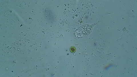 Microscopic green algae in a pond's drop observed at microscope Stock Footage 106994084