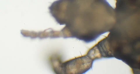 Microscopic head louse parasite moving on white background 스톡 동영상 333779550