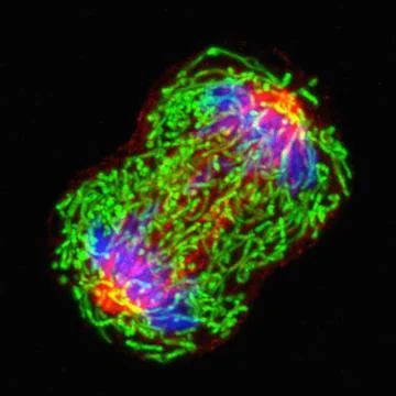 Microscopic image breast cancer cell dividing Stock Photos