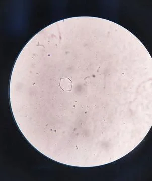 Microscopic image of Cystine crystal Stock Photos