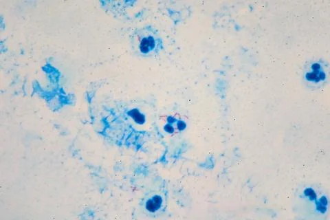 Microscopic image of Mycobacterium tuberculosis Stock Photos