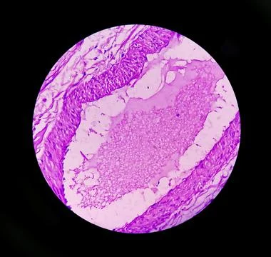 Microscopic image or photomicrograph of Fallopian tube biopsy. 스톡 사진