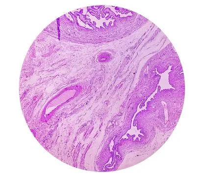 Microscopic image or photomicrograph of Fallopian tube biopsy. 스톡 사진