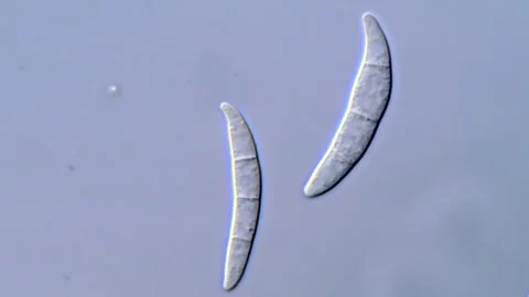 Microscopic Imaging of Fusarium Spore Development, 1000x 動画素材 317810523