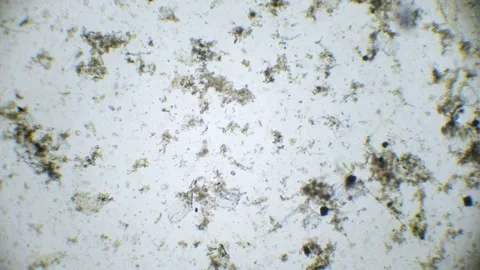 A microscopic lens captures the lively dance of paramecia and spirulina wit.. Stock Footage 275040668