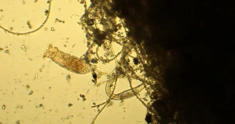 Microscopic life of microorganisms Stock Footage 87886185