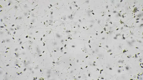 Microscopic microorganism distribution. Precise imaging of microbial Stock Footage 344086537