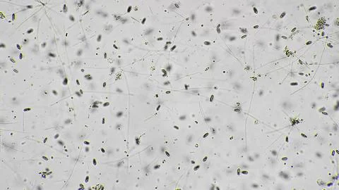 Microscopic microorganism distribution. Precise imaging of microbial Stock Photos