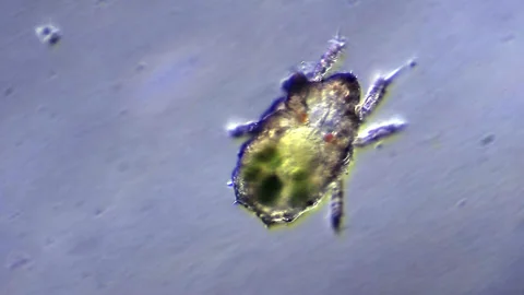 Microscopic mite view under microscope Stock Footage 220541786