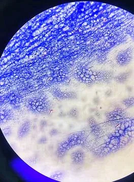 Microscopic morphology of Ziehl-Neelson staining of Mycobacterium species. Stock Photos