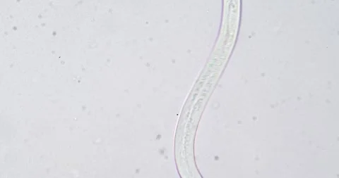 Microscopic nematode worm moving under microscope Stock Footage 334950125