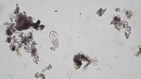 Microscopic Observation of Protozoa and Bacteria in Scientific Study 스톡 동영상 341925937