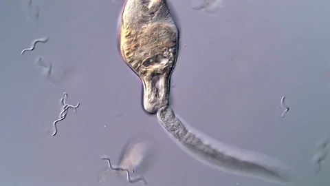 Microscopic Observation of Trematode Cercariae 库存影片 317223578