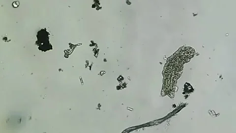 Microscopic organism observed in laboratory Stock Footage 223767772