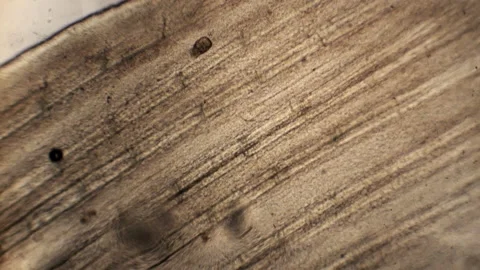 A microscopic parasite crawls on a fish. Stock Footage 157464135