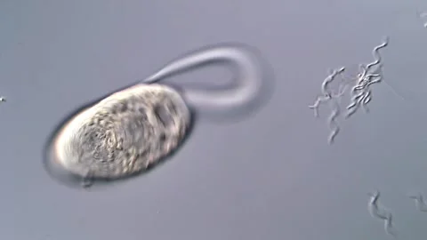 Microscopic Parasite Larvae and spirochetes Swimming in Water, fluke larvae 動画素材 317224705