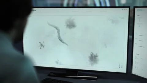 Microscopic Parasite Worm Analysis In An Innovative Scientific Software Vídeos de archivo 277908501