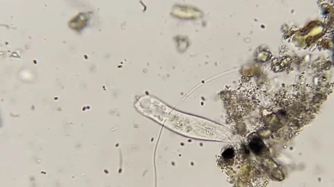 Microscopic Protozoa Stock Video Footage | Royalty Free Microscopic ...