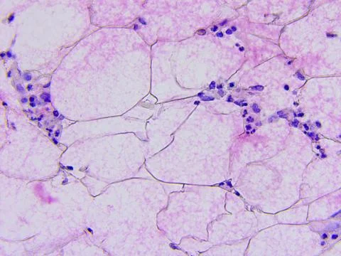 Microscopic photography of mucous membrane of the appendix, color test for en Stock Photos