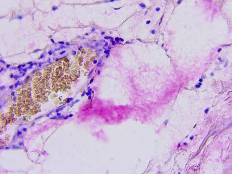 Microscopic photography of mucous membrane of the appendix, color test for en Stock Photos