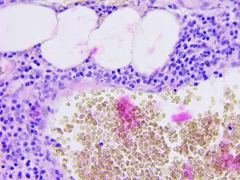 Microscopic photography of mucous membrane of the appendix, color test for en Stock Photos