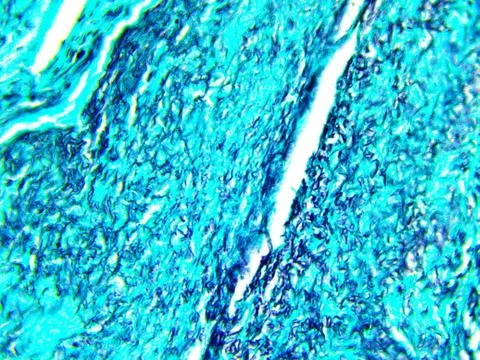 Microscopic photography of mucous membrane of the appendix, color test for en Stock Photos