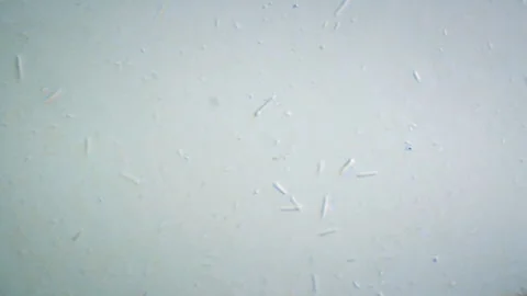 Microscopic Puddle Bacteria 01 Stock Footage 153451375