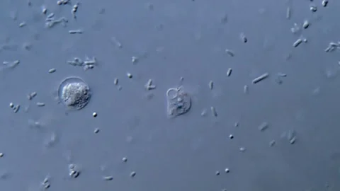 Microscopic Recording of Bacterial and protozoa parasite Activity Vídeos de archivo 317140934