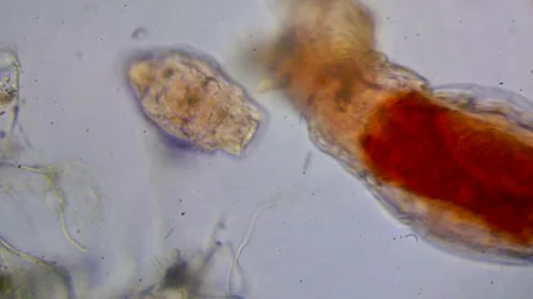 Microscopic rotifers of varying sizes Stock Footage 311743709