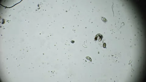 Microscopic scene of rotifers navigating water with organic particles, show.. Stock Footage 295032339